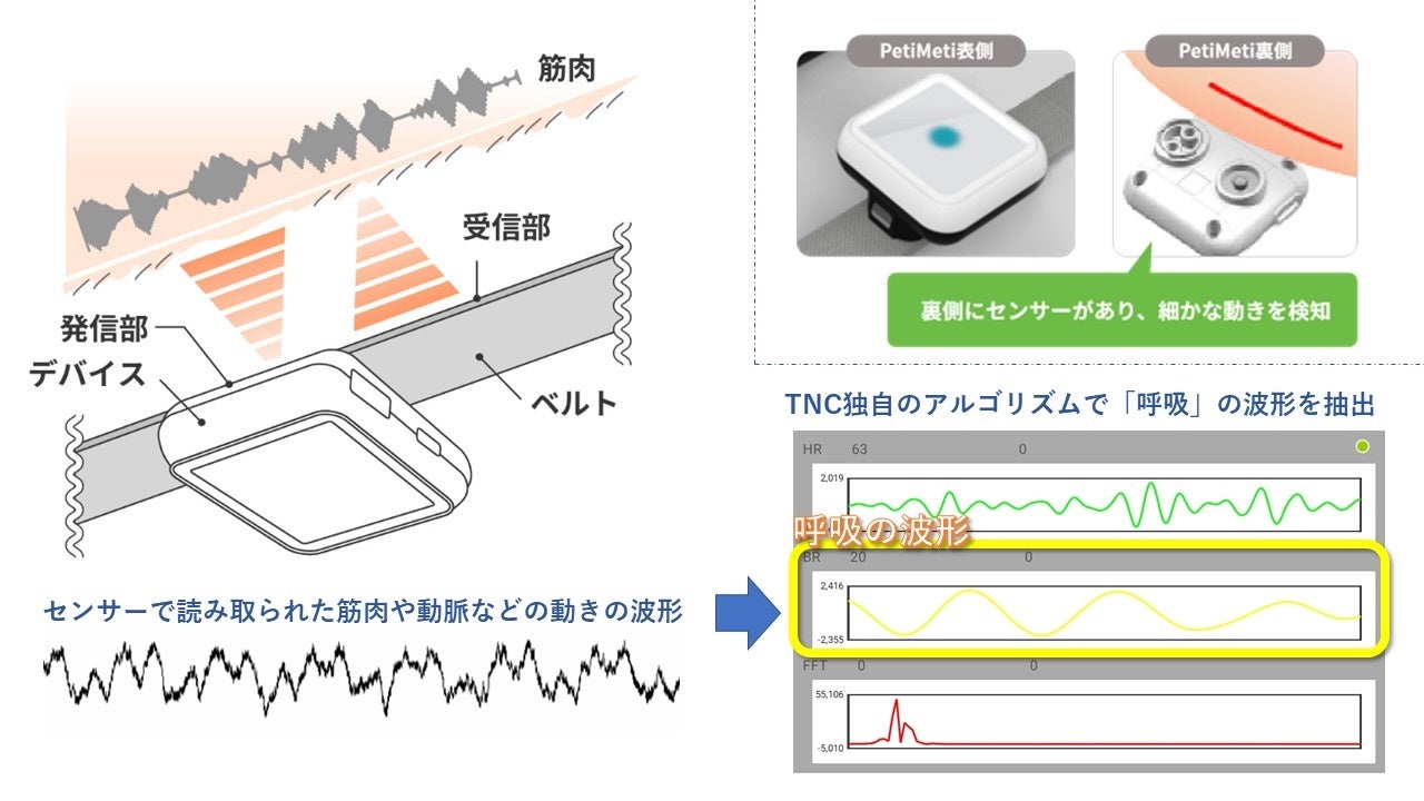 ペットのホームヘルスケアは呼吸数に着目。新世代ウェアラブルデバイス『PetiMeti』Makuakeで発売。のサブ画像9